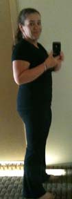 After Weight Loss Surgery Photo