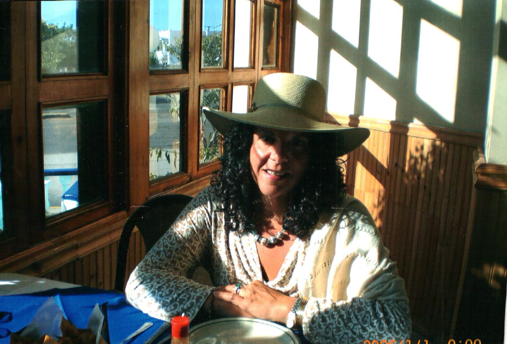 Marika After weight loss surgery recovery in Mexico