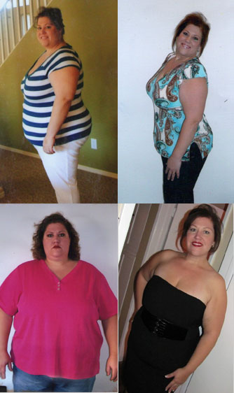 Weight loss Success Story Weight loss Success Story